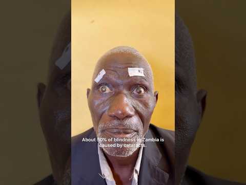 Impact of cataracts in Zambia 🇿🇲